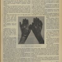 0531 - Page 519 - La pellagre en Algérie ; par J. Brault...