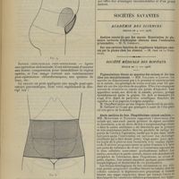 0818 - Page 810 - Sangles ou ceintures médico-chirurgicales pneumatiques à compression méthodique. (Appareils anti-ptosique, obstétrical et chirurgical, post-opératoire) ; par le Docteur Charnaux... / Sociétés savantes. Académie des sciences. (Séance du 9 juin 1908) / Société médicale des hôpitaux. (Séance du 12 juin 1908). Pigmentations bleues en macules des cuisses et des bras chez une morphinomane. MM. Galliard et Lasnier / Abcès amibien du foie. Phagédénisme cutané amibien. MM. Ménétrier et Touraine / Sporotrichose. MM. Hudelo et Monier-Vinard