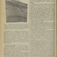 0948 - Page 940 - Revue générale. Symphyse cardiaque ; par M. André Bergé... Etiologie / Anatomie pathologique