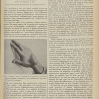 1141 - Page 1143 - Tuberculose inflammatoire. Un cas de rhumatisme tuberculeux articulaire et abarticulaire ; par M. Jean Rhenter... (Travail de la clinique chirurgicale de M. le Professeur Poncet)
