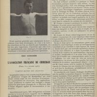 1406 - Page 1410 - Raccourcissement de l'humérus par résection de l'épaule pratiquée en bas âge ; par le Docteur Broca / XXIe Congrès de l'association française de chirurgie. (Paris, 5-10 octobre 1908). Compte rendu des séances. MM. Delagénière et Gosset : Chirurgie du cholédoque et de l'hépatique