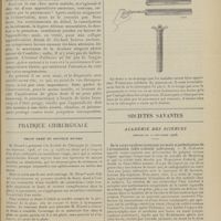 1777 - Page 1781 - Hôpital des enfants malades. (Service de M. Broca). Pneumonie simultanée chez le frère et la soeur. Appendicite et pneumonie ; par M. Railliet... / Pratique chirurgicale. Drain armé du Docteur Ricard / Sociétés savantes. Académie des sciences. (Séance du 21 décembre 1908). De la carpo-cyphose (anatomie normale et pathologique de l'articulation radio cubitale inférieure). M. Robinson / L'homme fossile de la Chapelle-aux-Saints (Corrèze). MM. A. et J. Bouyssounie et L. Bardon