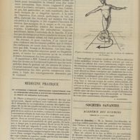 0082 - Page 76 - A propos du tétanos ; par L. Vaillard... / Médecine pratique. Un syndrome d'origine médullaire caractérisé par la démarche spiroïde, l'attitude d'équilibriste et la perte du réflexe rotulien. [L. Babonneix] / Sociétés savantes. Académie des sciences. (Séance du 4 janvier 1909). Lèpre et démodex. M. A. Borrel