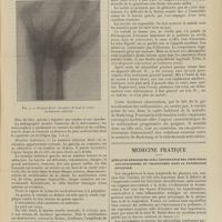 0197 - Page 191 - La maladie de Madelung. Ses modalités, sa pathogénie ; par MM. Antonin Poncet et René Leriche / Médecine pratique. Quelques remarques sur l'importance des infections amygdaliennes et pharyngées dans la pathologie infantile. [L. Babonneix]