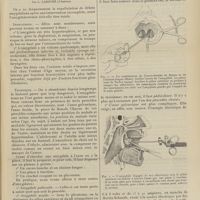 0281 - Page 275 - Indications et technique de l'amygdalectomie totale ; par L. Labouré...