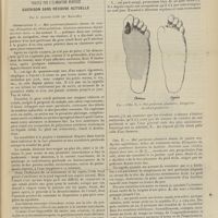 0413 - Page 407 - Trois cas de mal perforant plantaire traités par l'élongation nerveuse. Guérison sans récidive actuelle ; par le Docteur Lop...