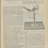 1141 - Page 1135 - De la mécanothérapie dans les accidents du travail. Ce qu'il faut penser de sa valeur thérapeutique (Quatre années de pratique) ; par M. le Docteur Lop...