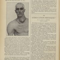 1250 - Page 1244 - Clinique chirurgicale. Goitre métastatique avec tumeur secondaire de la clavicule ; par M. le Professeur Jaboulay / De l'éducation physique ; par le Général Fr. Canonge...