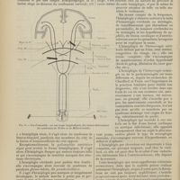 1782 - Page 1776 - Revue générale. Symptômes et diagnostic de l'hémiplégie ; par M. Milhit... III. Diagnostic / IV. Diagnostic de la nature de la lésion