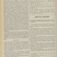 0602 - Page 590 - Abcès par congestion et hernie lombaire ; par C. Claeys... / Médecine pratique. Une nouvelle méthode de diagnostic des maladies infectieuses et des tumeurs malignes : la méiostagmie. [M. Lance]