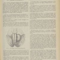 1045 - Page 1033 - Sur le diagnostic des tumeurs de la protubérance annulaire ; par L. Alquier et B. Klarfeld