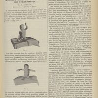 1073 - Page 1061 - Procédés de recherche de la résistance à la fatigue chez l'enfant. Rapports de ce phénomène avec l'évolution de l'être. Essai de valeur pronostique ; par André Collin...