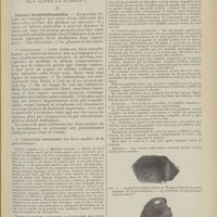 1121 - Page 1109 - Sur le diagnostic des tumeurs de la protubérance annulaire ; par L. Alquier et B. Klarfeld