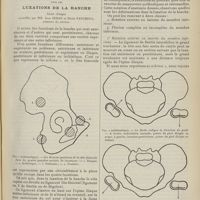 1267 - Page 1255 - Hôpitaux de Marseille. Service du Professeur Léon Imbert sur les attitudes du membre inférieur dans les luxations de la hanche. Leçon clinique recueillie par MM. Jean Sedan et Henri Faucheux...