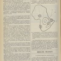 1268 - Page 1256 - Hôpitaux de Marseille. Service du Professeur Léon Imbert sur les attitudes du membre inférieur dans les luxations de la hanche. Leçon clinique recueillie par MM. Jean Sedan et Henri Faucheux... / Médecine pratique. La scopolamine en obstétrique. [M. Lance]