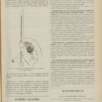 1343 - Page 1331 - Une sonde bivalve autofixatrice ; par MM. Jean Fiolle... et Paul Fiolle... / Sociétés savantes. Académie des sciences. (Séance du 24 juillet 1911). Au sujet de l'oxazine (chlorure de triaminophénazoxonium) sur les trypanosomes. MM. Laveran et Roudsky / Considérations sur les réactifs employés pour la détermination des taches de sang en médecine légale. M. Bordas / Recherches sur la pathogénie des lésions artério-scléreuses. M. Y. Manouëlian / Sur la thérapeutique mercurielle de la syphilis expérimentale du lapin et de la spirillose brésilienne. MM. L. Launoy et C. Levaditi / Jurisprudence. De la responsabilité médicale. Conférence faite à la société des médecins du VIe arrondissement de Paris, le 1911. [R.-Marcle Petit]