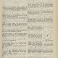 1399 - Page 1387 - Orthopédie de la confection des appareils plâtrés dans le traitement du pied bot varus équin congénital, par M. L. Lamy...