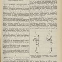 1423 - Page 1411 - Revue générale. Les traumatismes du carpe ; par M. Henri Bertier... I. Historique et définition / II. Anatomie pathologique et mécanisme