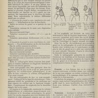 1426 - Page 1414 - Revue générale. Les traumatismes du carpe ; par M. Henri Bertier... V. Diagnostic / VI. Pronostic / VII. Traitement