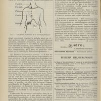 1610 - Page 1598 - Revue générale. Les pleurésies enkystées. Par Henri Paillard... Pleurésies diaphragmatiques. Syndrome de la pleurésie diaphragmatique. (Cliniques de la Pitié, 1885). (A suivre) / Bulletin bibliographique