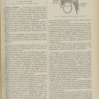 1639 - Page 1627 - Revue générale. Les pleurésies enkystées ; par Henri Paillard... Formes cliniques