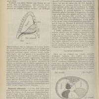 1640 - Page 1628 - Revue générale. Les pleurésies enkystées ; par Henri Paillard... Formes cliniques / Diagnostic différentiel / Pleurésies médiastines