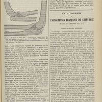1779 - Page 1767 - L'olécrane possède normalement deux points d'ossification ; par M. J. Andrieu... / XXIVe Congrès de l'association française de chirurgie (Paris, 2-7 Octobre 1911). Communications diverses