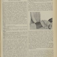 0531 - Page 523 - Médecine pratique. Examen clinique de la fonction diaphragmatique ; par Henri Paillard...