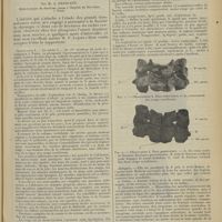 0585 - Page 577 - Les fractures du rachis cervical chez les plongeurs ; par M. A. Dejouany...