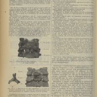 0586 - Page 578 - Les fractures du rachis cervical chez les plongeurs ; par M. A. Dejouany...