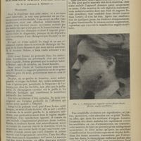 0665 - Page 657 - Clinique chirurgicale (Hôtel-Dieu de Lyon). Actinomycose cervico-faciale gauche ; par M. le Professeur A. Poncet