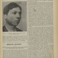 0667 - Page 659 - Clinique chirurgicale (Hôtel-Dieu de Lyon). Actinomycose cervico-faciale gauche ; par M. le Professeur A. Poncet / Médecine pratique. Des fractures de la diaphyse du fémur chez l'enfant et en particulier de leur traitement. [M. Lance]