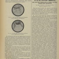 0876 - Page 868 - Du traitement du cancer de l'oesophage (en particulier dans les cas au début) par les applications locales directes de radium ; par M. Guisez / Un cas de contusion abdominale avec rupture musculaire & hernie ventrale traumatique secondaire ; par MM. Phélip et de Beaufond...