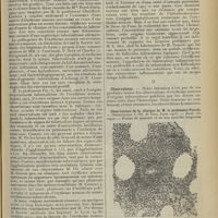 1037 - Page 1029 - Clinique chirurgicale (Hôtel-Dieu de Lyon. Professeur A. Poncet). L'érythème noueux d'origine tuberculeuse. Contribution à l'étude de la tuberculose inflammatoire de la peau ; par M. H. Alamartine... I. Historique et évolution des idées / II. Observations
