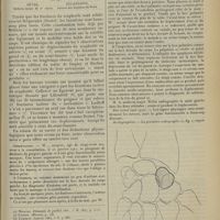 1255 - Page 1247 - Sur un cas de subluxation isolée du scaphoïde carpien ; par MM. Duval... et Ducastaing...
