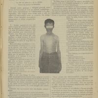 1411 - Page 1403 - Poliomyélite antérieure à début scapulo-huméral chez un tuberculeux syphilitique ; par Mlle M. Giraud et M. C. Gueit...