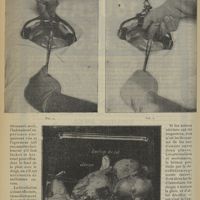 0598 - Page 586 - Du procédé de la décollation antérieure dans l'hystérectomie abdominale ; par M. A. Ricard...