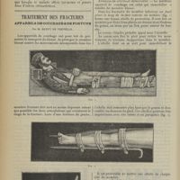 1134 - Page 1126 - Un cas curieux de phobie professionnelle chez un prêtre (la peur de l'autel). Par Paul Sainton... / Traitement des fractures. Appareils de couchage et de fortune ; par M. Dupuy de Frenelle