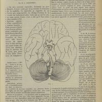 1261 - Page 1253 - Anévrisme de l'artère vertébrale et néphrite interstitielle chez une jeune femme. Syphilis probable. Par M. L. Babonneix