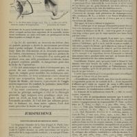 1320 - Page 1312 - Un cas de procidence mastoïdienne de la dure-mère de la fosse cérébrale moyenne. Par Jacques Fournié... / Jurisprudence. Responsabilité et refus de soins. [R.-Marcel Petit]
