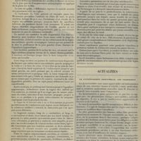 1754 - Page 1746 - Clinique chirurgicale de « La Joliette ». Deux observations de chirurgie crânienne d'urgence. Par M. Lop... / Actualités. La dysménorrhée essentielle. Son traitement. [R. de Butler]