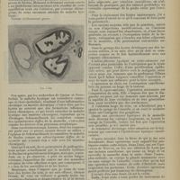 2125 - Page 2117 - Revue générale. Des kystes du sein. Par M. P. Alglave... Maladie kystique de la mamelle / Traitement des kystes du sein