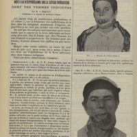 2182 - Page 2174 - Note à propos de l'épidémie de Cholet. Par MM. G. Ollive..., et Collignon... / Deux cas d'épithélioma de la lèvre inférieure chez des femmes indigènes. Par M. J. Brault...