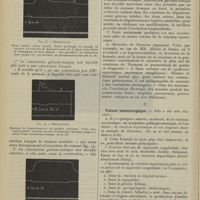 2220 - Page 2212 - Revue générale. La réaction myotonique ; par M. L. Babonneix. I. La réaction myotonique / II. Valeur séméiologique