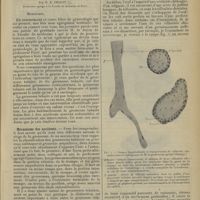 0095 - Page 85 - De l'intervention opératoire dans les grossesses tubaires ; par M. R. Proust...