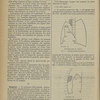 0258 - Page 248 - Revue générale. Les dextrocardies par attraction ; par M. Lucien Girard... III. Syndrome clinique / IV. Diagnostic