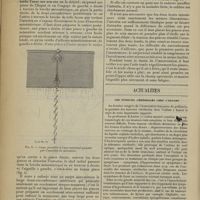 0380 - Page 370 - Technique d'anastomose termino-terminale de l'intestin grêle ; par M. René Toupet... / Actualités. Les tumeurs cérébrales chez l'enfant. [M. Brelet]
