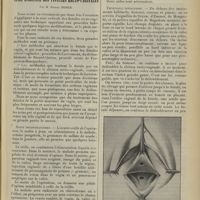 0749 - Page 753 - Quelques modifications de technique à la cure radicale des fistules recto-vaginales ; par M. Robert Didier