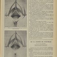 0751 - Page 755 - Quelques modifications de technique à la cure radicale des fistules recto-vaginales ; par M. Robert Didier / De la chorée de Sydenham ; par M. Pierre Maurel...