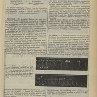 0833 - Page 837 - Revue générale. Le réflexe oculo-cardiaque ; par MM. Maurice Vernet... et Petzetakis... I. Historique / II. Le réflexe